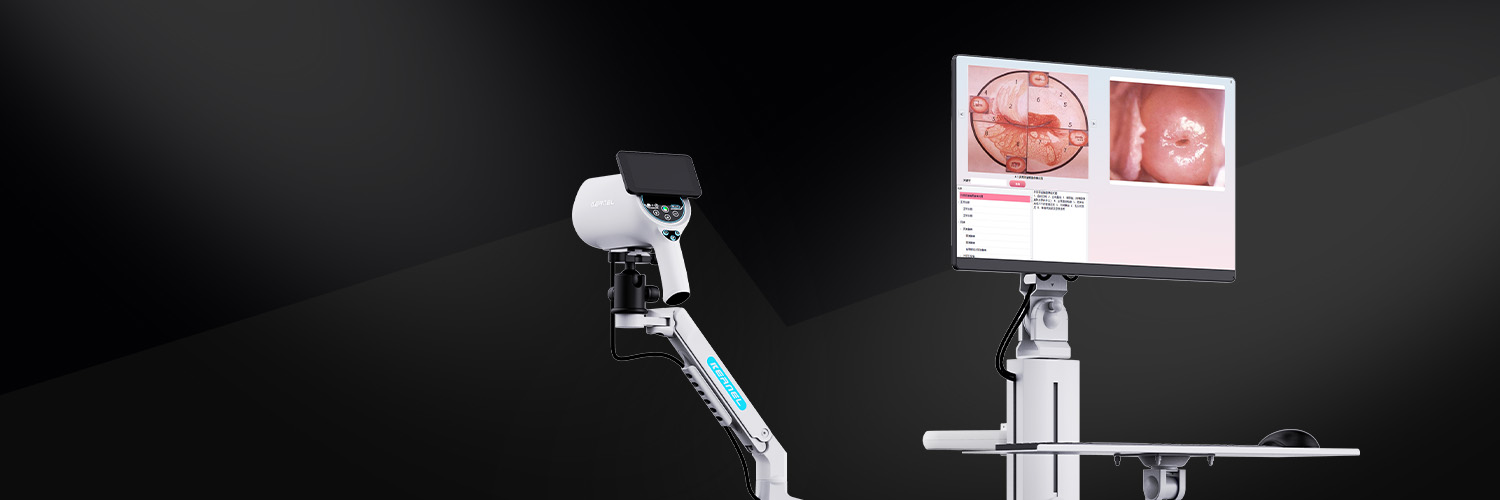 高分辨率高清晰度数码ccd